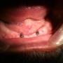 debrecen, debreceni fogászat, dentland, fémmentes implantáció, fog implant, fogászat, fogsor, fogsor pótlás, implant